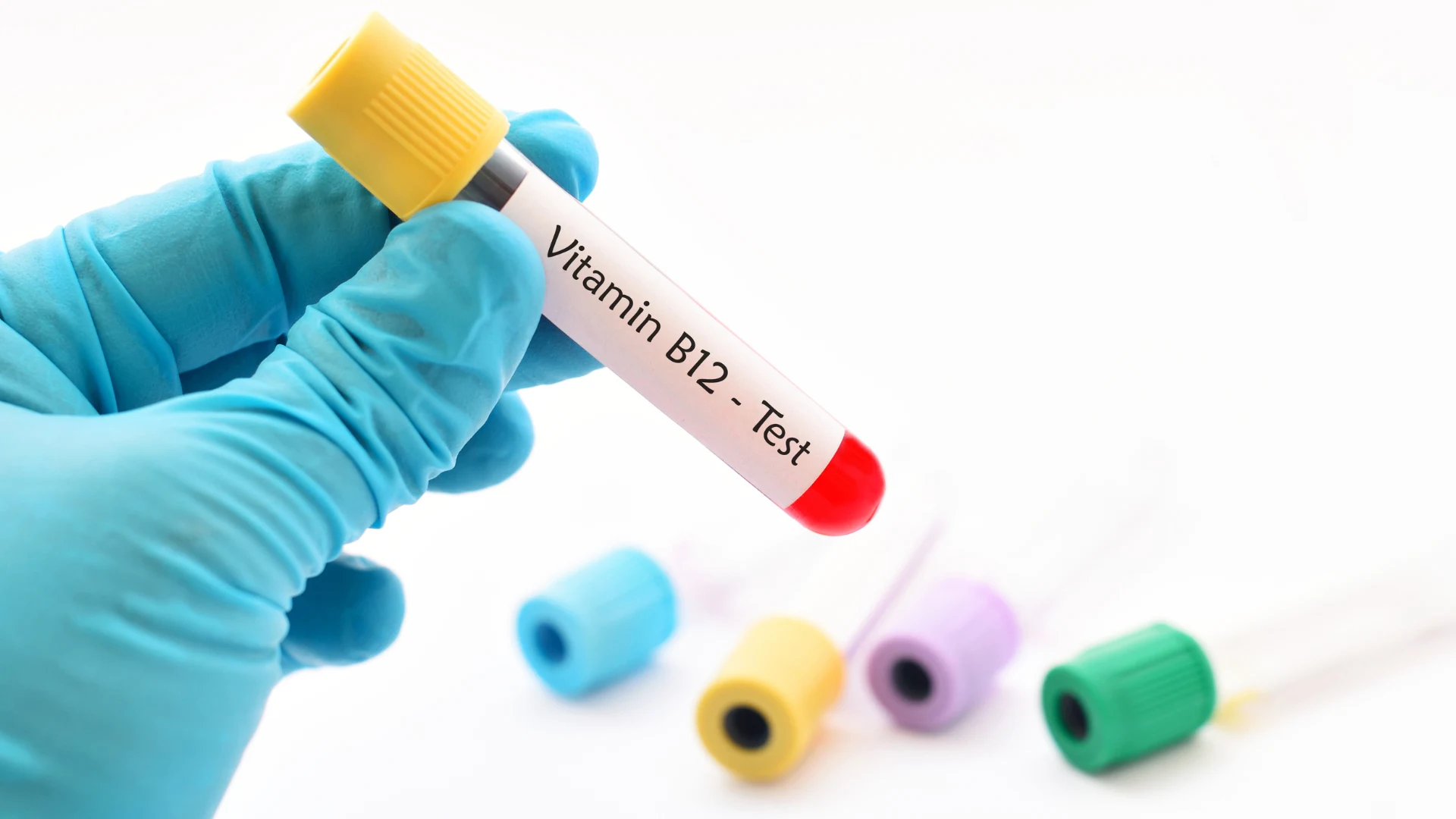 Vitamin B12 Test